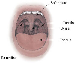 Illustration of the mouth and the location of the tonsils